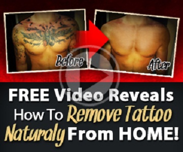 Remove Tattoo at Home